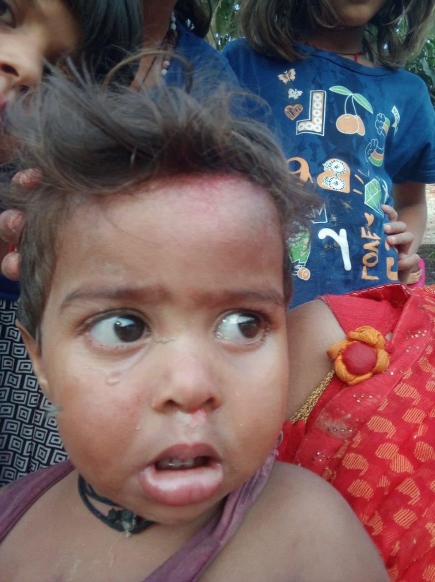 सोखता गड्ढा में गिरी मासूम घायल--