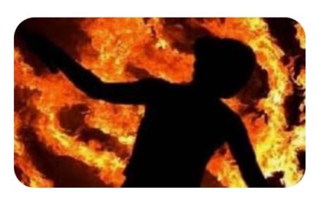 आग से झुलसी युवती की इलाज के दौरान मौत