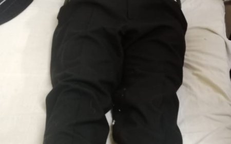 सीएमओ ने सीडीओ पर लगाया अभद्रता का आरोप, मंडलायुक्त को सौंपा सामूहिक इस्तीफा