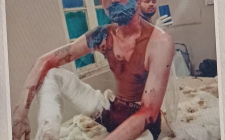 रसोई गैस के रिसाव से झुलसे पिता पुत्र की मौत