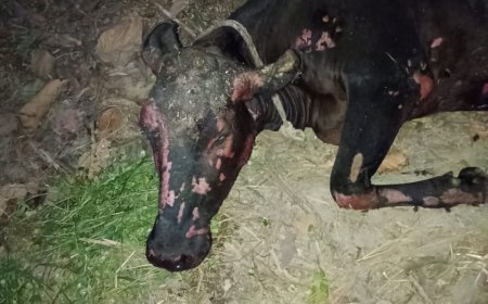 बीती रात आग बुझाने में झुलस गये योगी