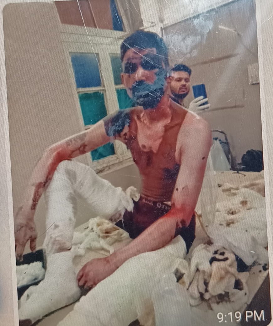 रसोई गैस के रिसाव से झुलसे पिता पुत्र की मौत