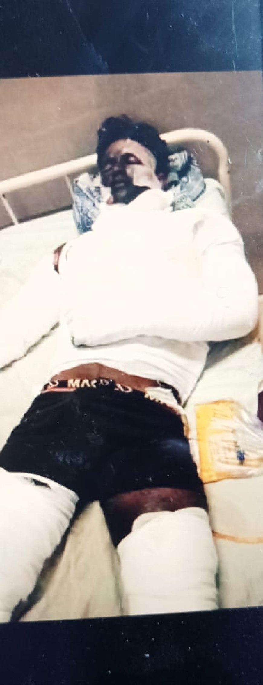 रसोई गैस के रिसाव से झुलसे पिता पुत्र की मौत