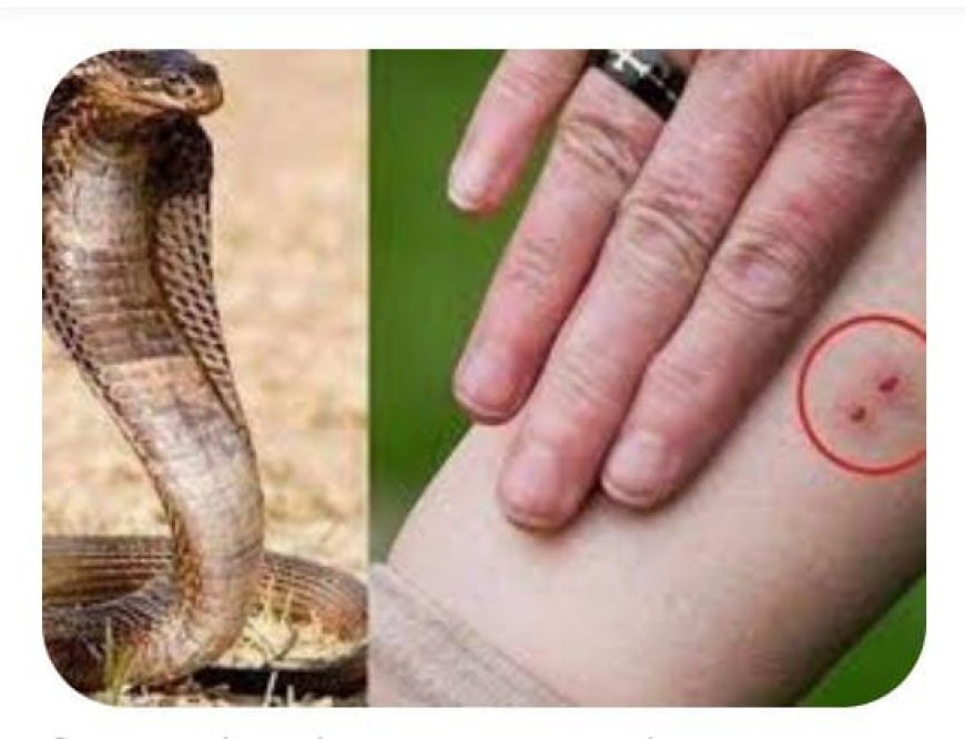 सर्पदंश से महिला की हालत बिगड़ी