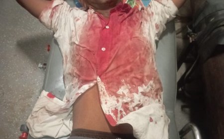 झाड़ू लगाने से उड़ी धूल तो भतीजी सहित बड़े भाई व भाभी को पीटा, मुकदमा दर्ज