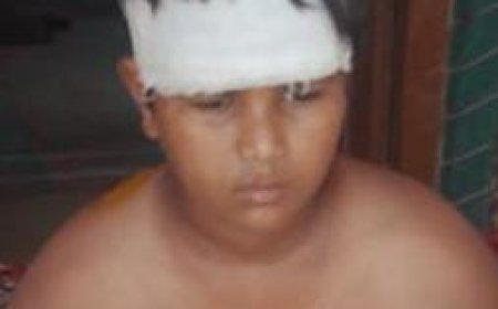 अनियंत्रित बाइक सवार ने किशोर को मारी टक्कर, हालत गंभीर