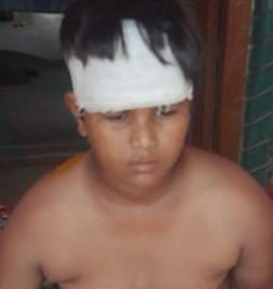 अनियंत्रित बाइक सवार ने किशोर को मारी टक्कर, हालत गंभीर