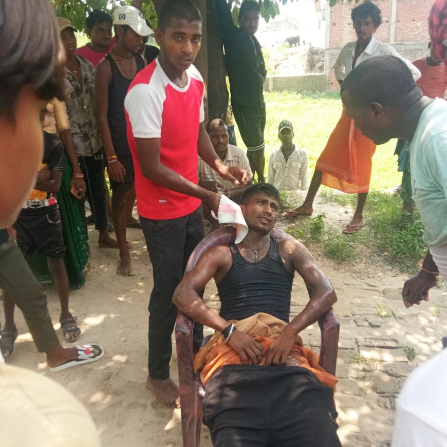 मटकी टांग रहा युवक करंट की चपेट में आकर झुलसा