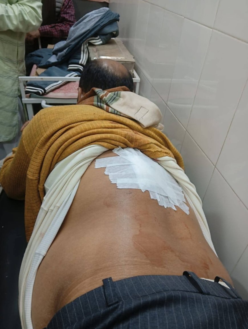 भाजपा नेता को बदमाशों ने मारी गोली,गंभीर
